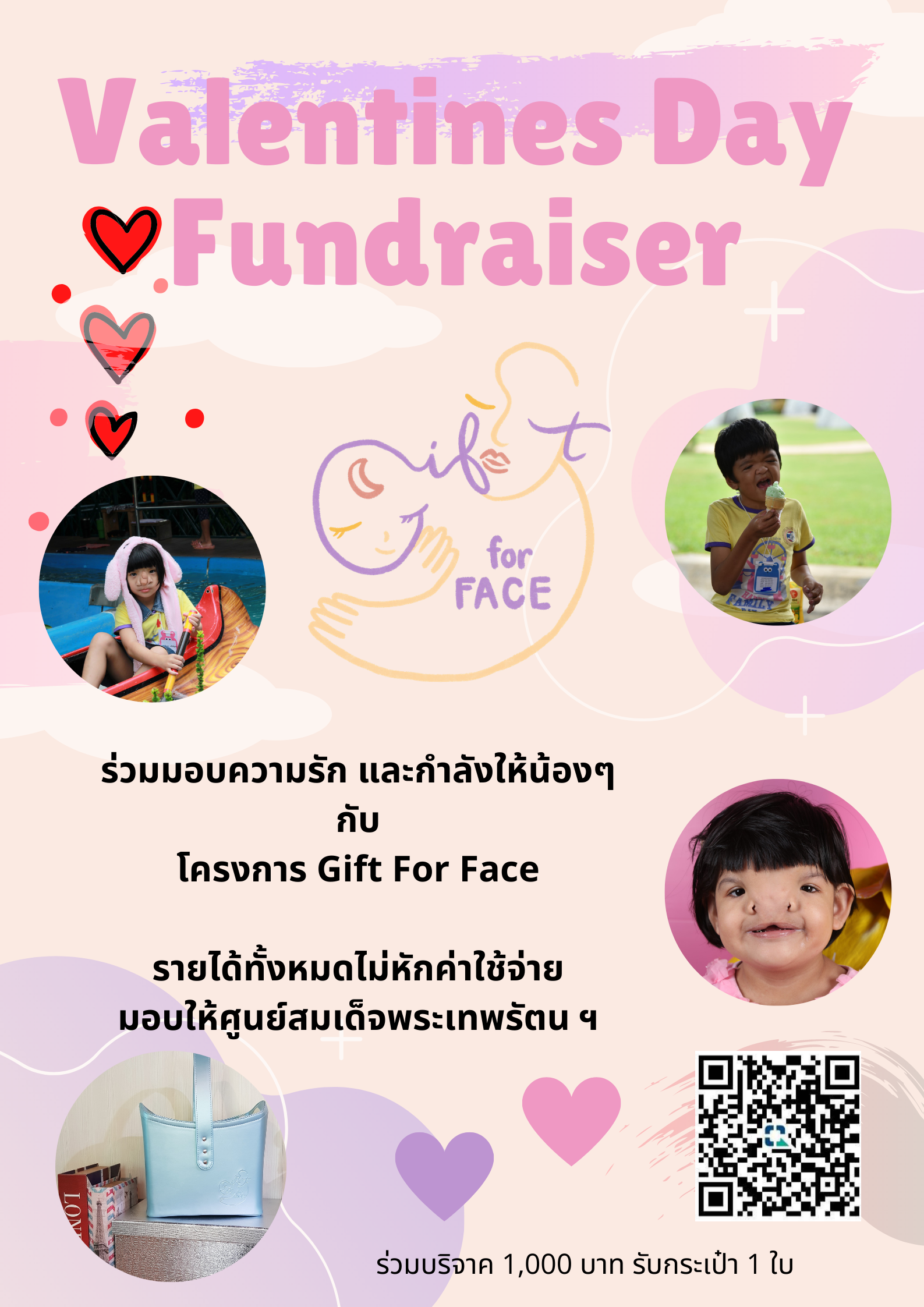 เปิดรับบริจาคของขวัญวันวาเลนไทน์ให้น้อง ๆ ในรูปแบบของเงินบริจาคเพื่อศูนย์สมเด็จพระเทพรัตนฯ แก้ไขความพิการบนใบหน้าและศีรษะ โรงพยาบาลจุฬาลงกรณ์ สภากาชาดไทย