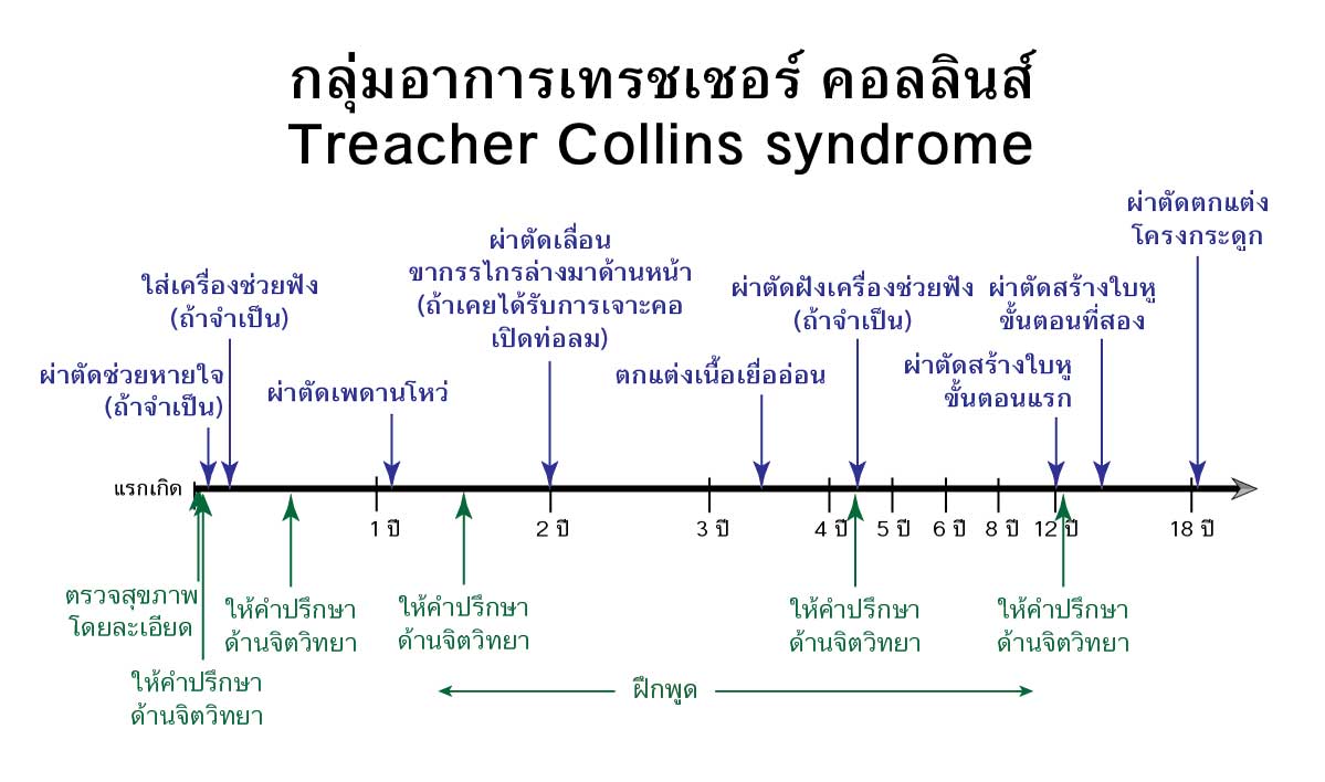 ลำดับเวลาการรักษาผู้ป่วยด้วยกลุ่มอาการเทรชเชอร์ คอลลินส์